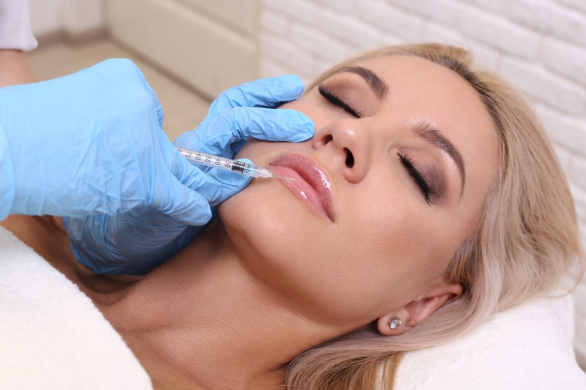 Tout savoir sur l'injection lèvre 1 ml avant après pour des lèvres