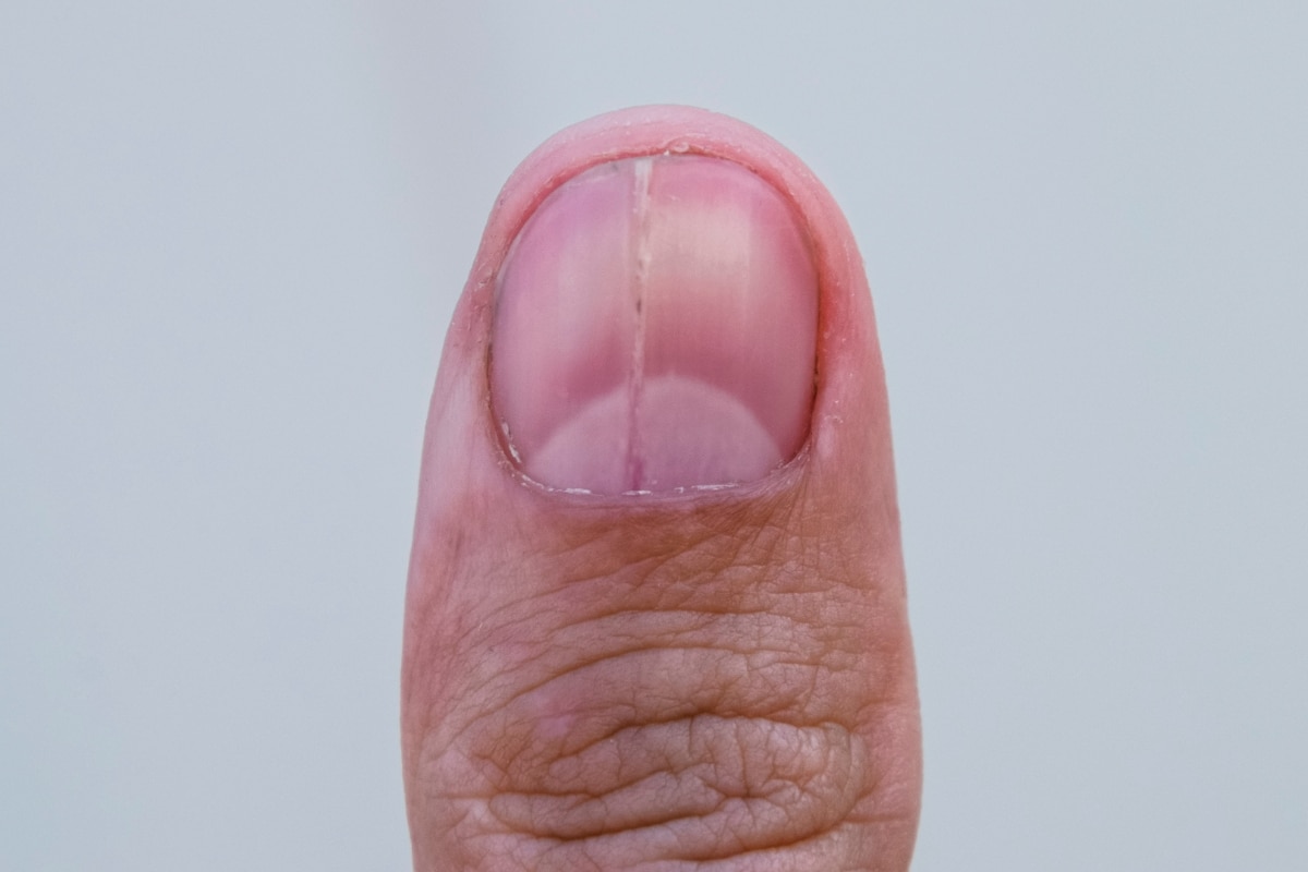 matrice ongle